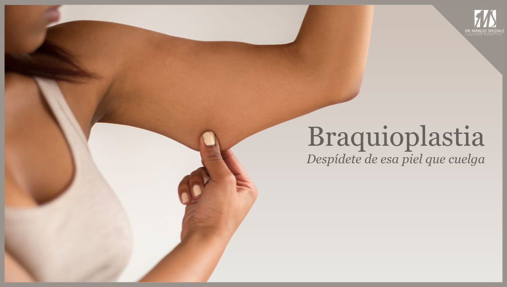 Braquioplastia o lifting braquial